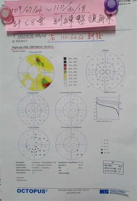 千里目視力訓練中心|千里目視力訓中心 新竹市東 區西大路639號